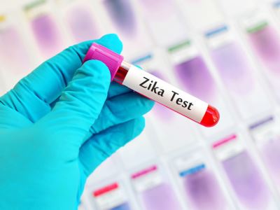 TP.HCM đã có 17 trường hợp mắc vi rút Zika